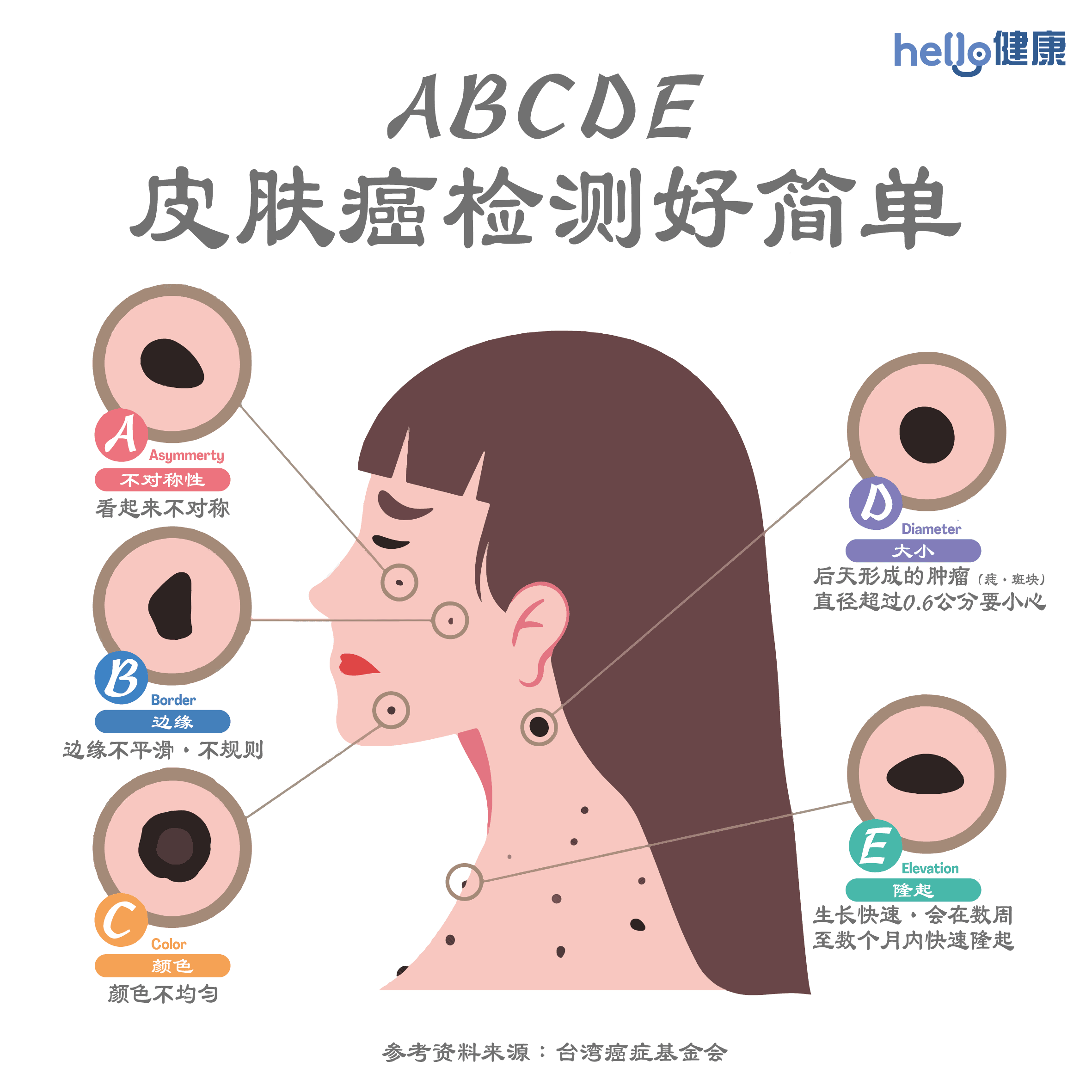 ABCDE-skin-cancer-check