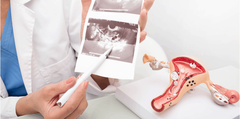 endometrial-cancer-4-stages-and-diagnosis