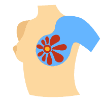 乳癌