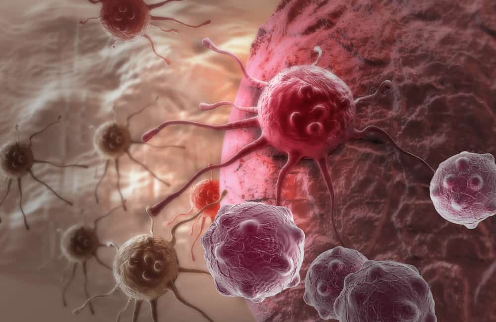abnormal-cells-carcinoma-in-situ