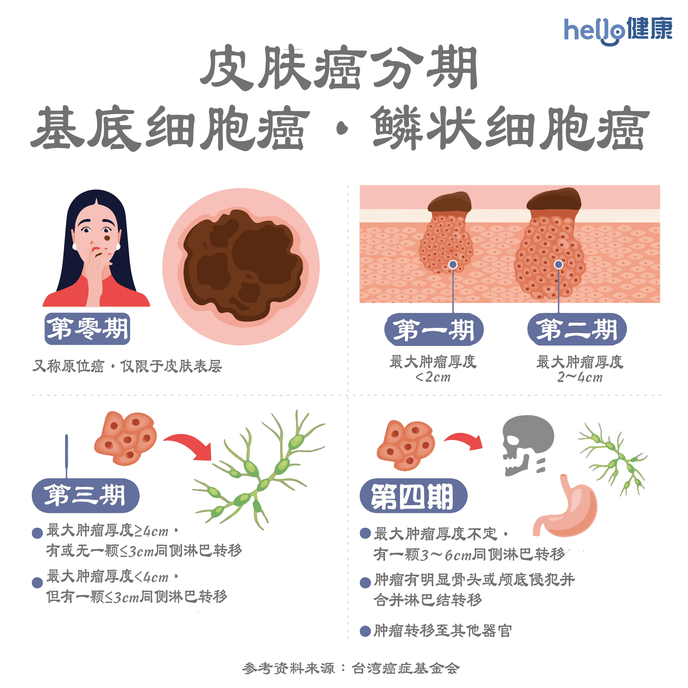 皮肤癌分期