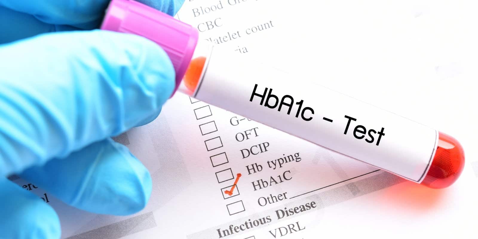 normal-hemoglobin-a1c-hba1c-levels