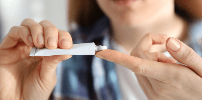 do-topical-steroid-creams-have-many-side-effects