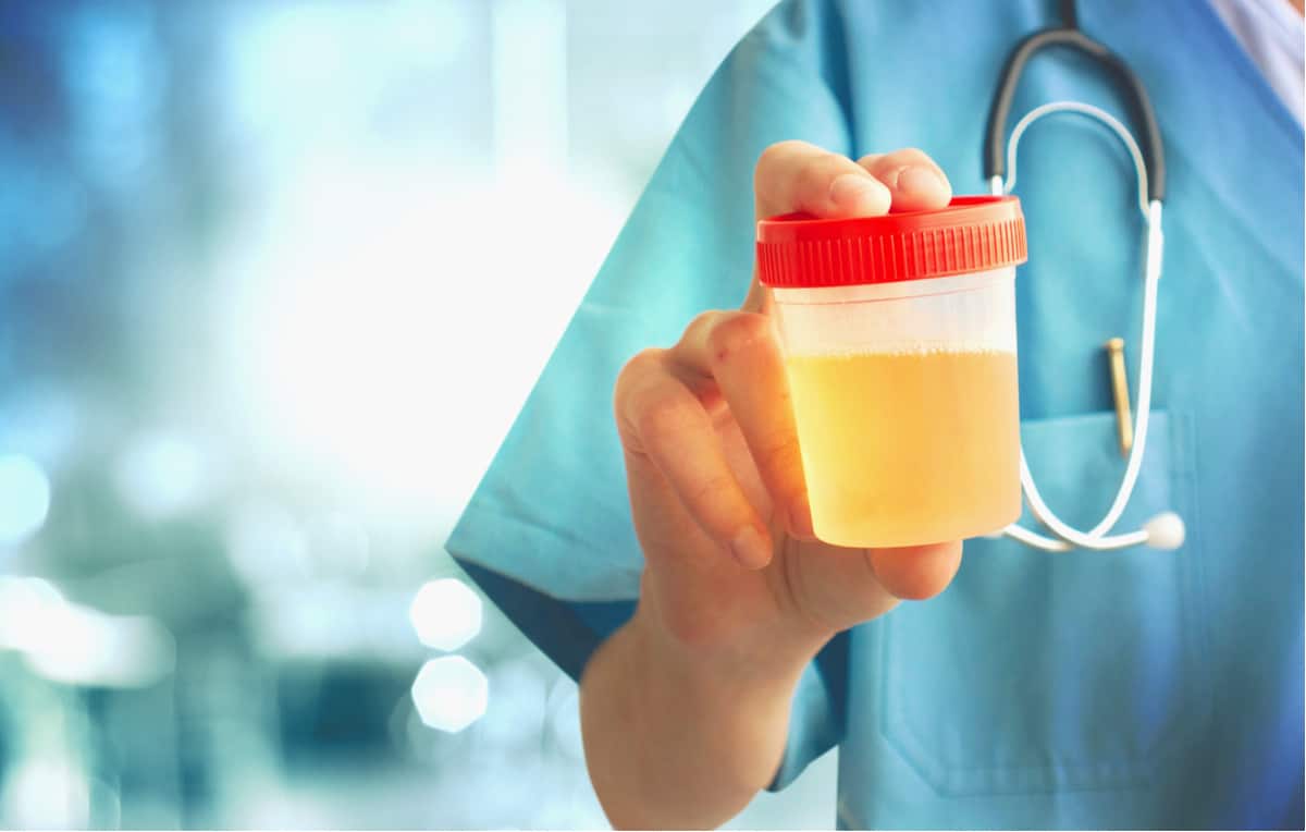 糖尿病测尿酮控制病情！尿酮体过高请就医