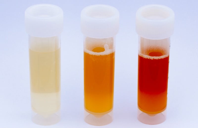 urine-color-reflects-your-health