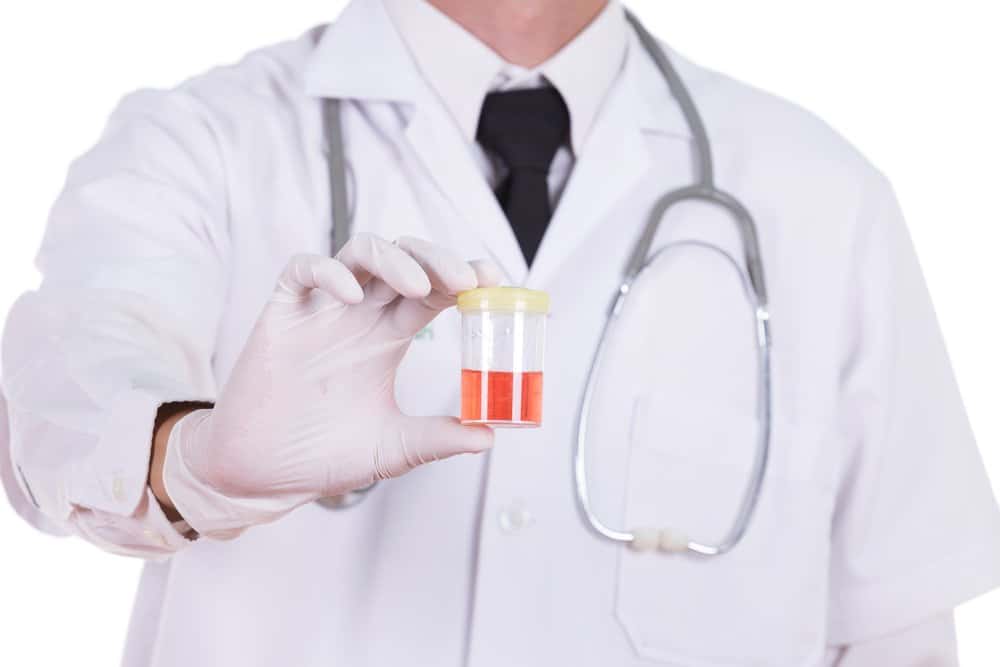 causes-symptoms-prevention-and-treatment-of-hematuria