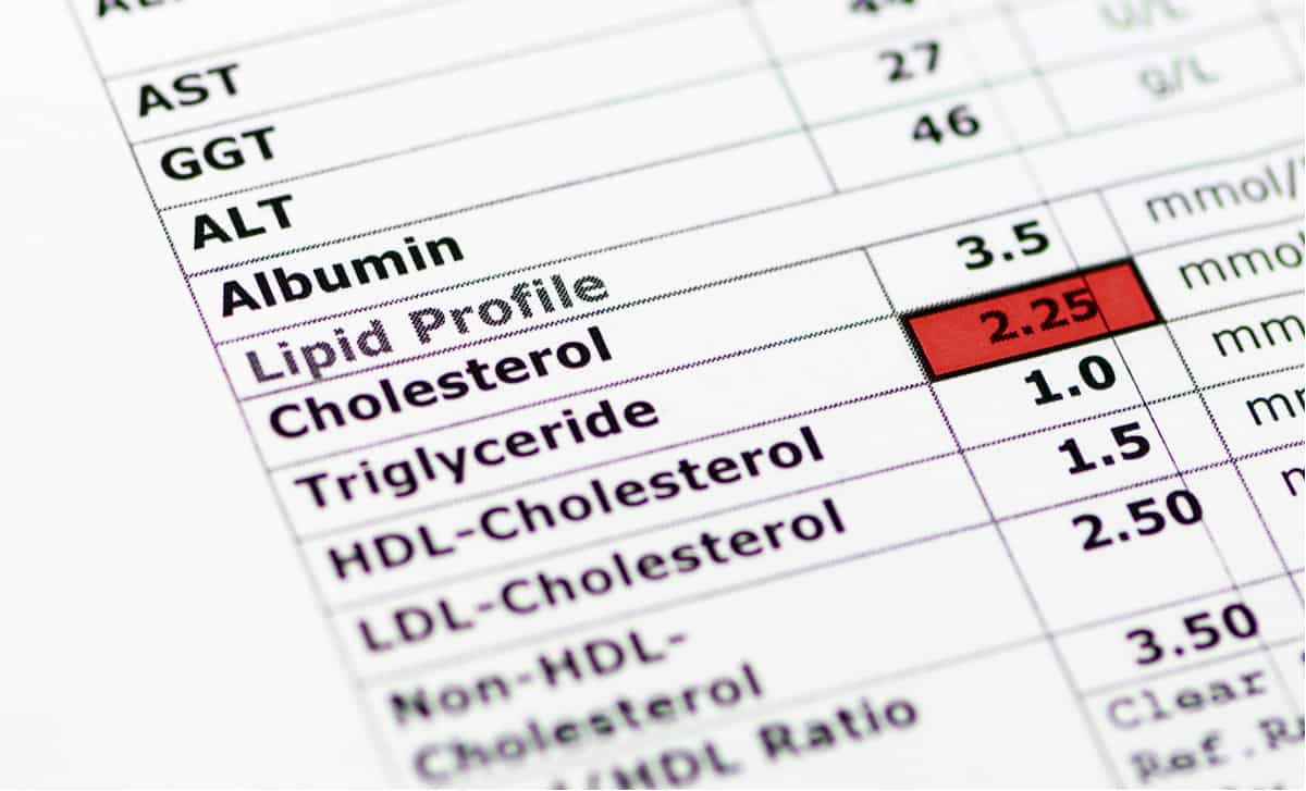 what-to-do-if-your-triglycerides-are-too-high