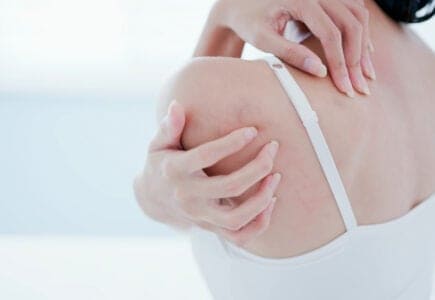 生蛇很痛怎么办？带状疱疹治疗案例：得过仍可打疫苗，提升保护力