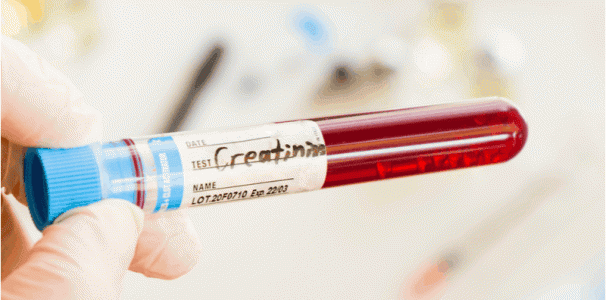 how-to-improve-creatinine-levels