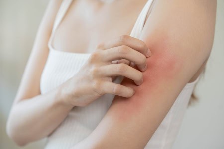 unexplained-skin-itching