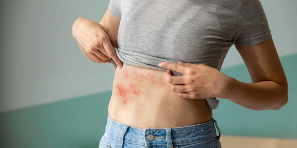 postherpetic-neuralgia-difficult-to-treat-complication