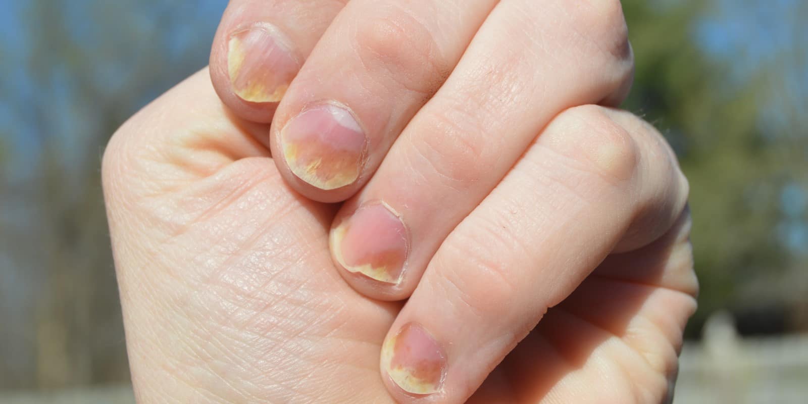 nail-color-can-reflect-your-overall-health