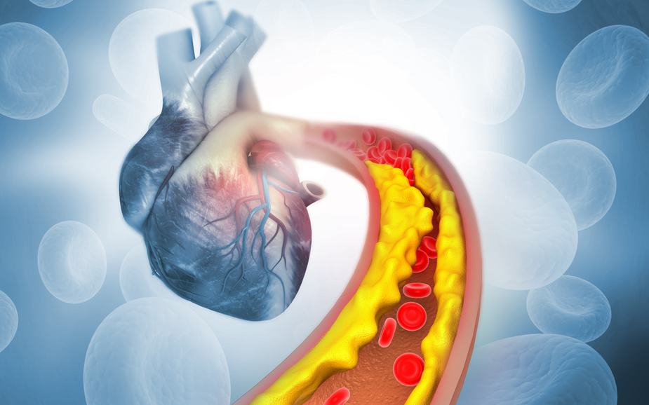 is-cholesterol-good-or-bad-for-our-body