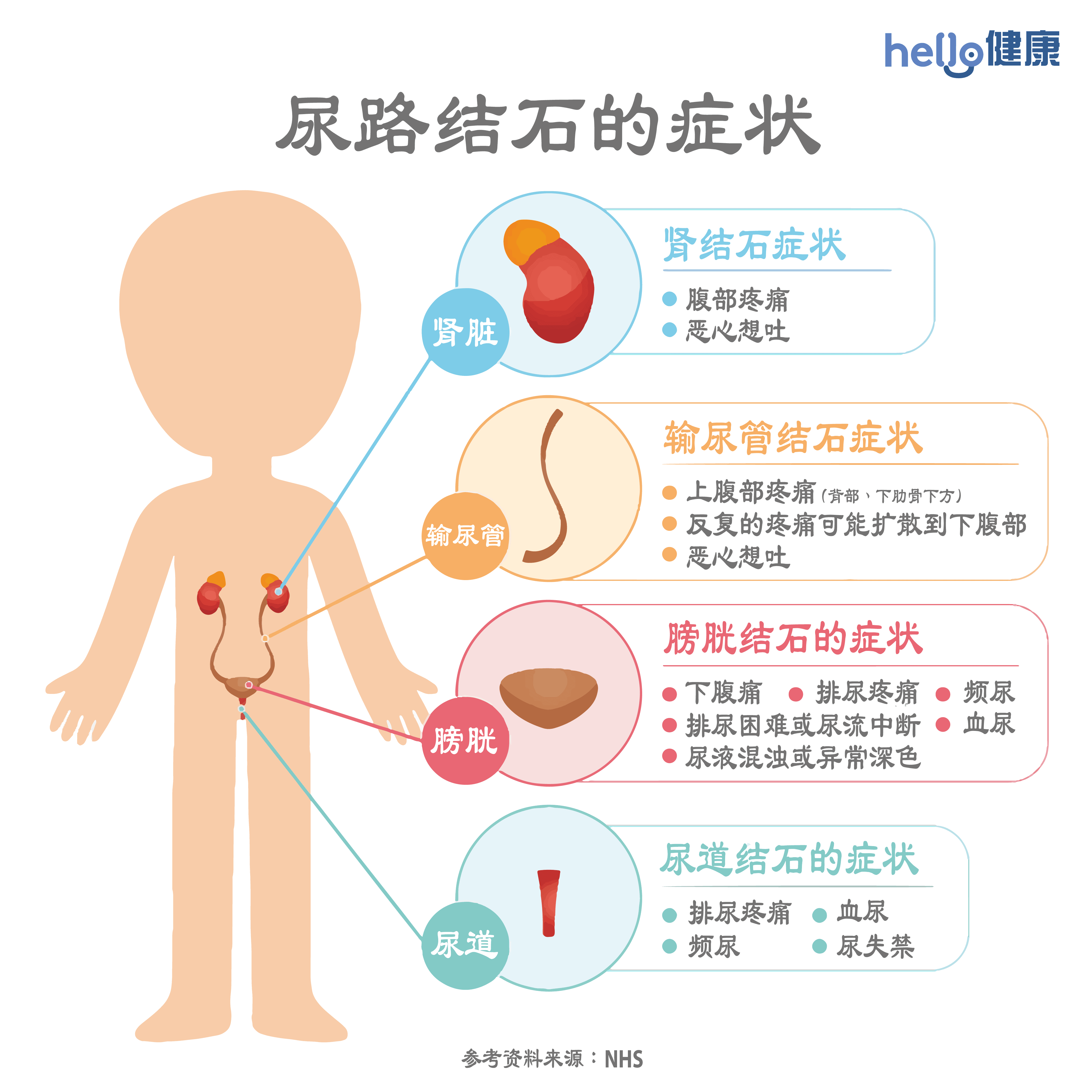 尿路结石的症状-01