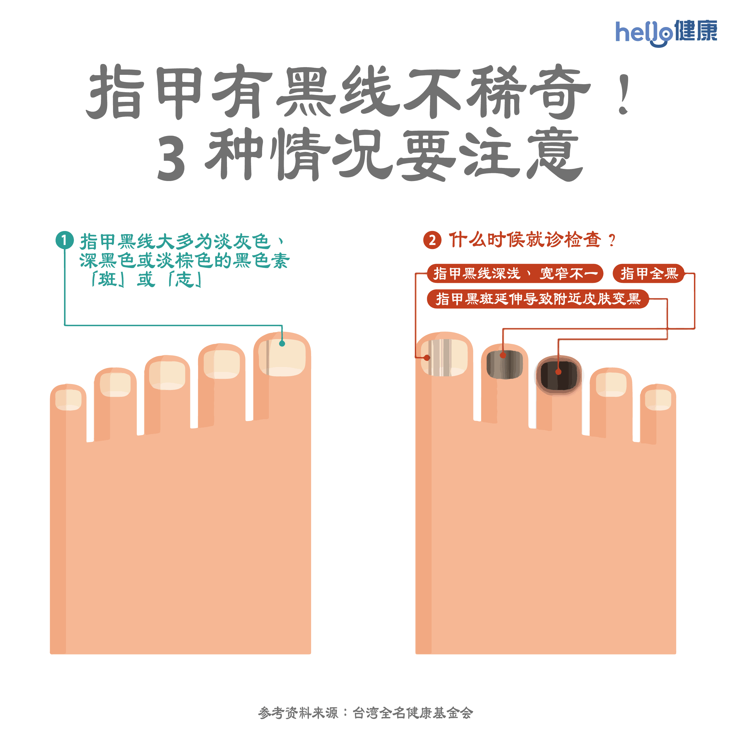 指甲有黑线不稀奇