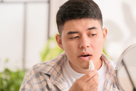 唇炎是什么？唇炎分2种，症状原因大不同！治疗药膏完整看
