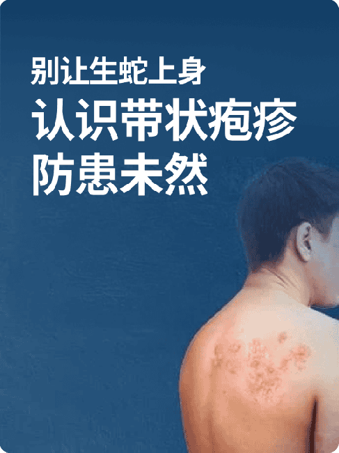别让生蛇上身！认识带状疱疹，防患未然