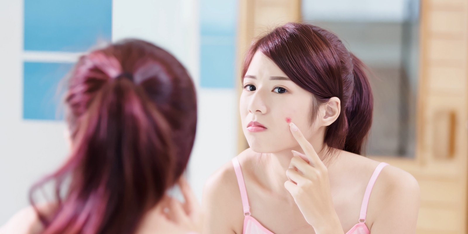 tips-to-prevent-and-treat-acne