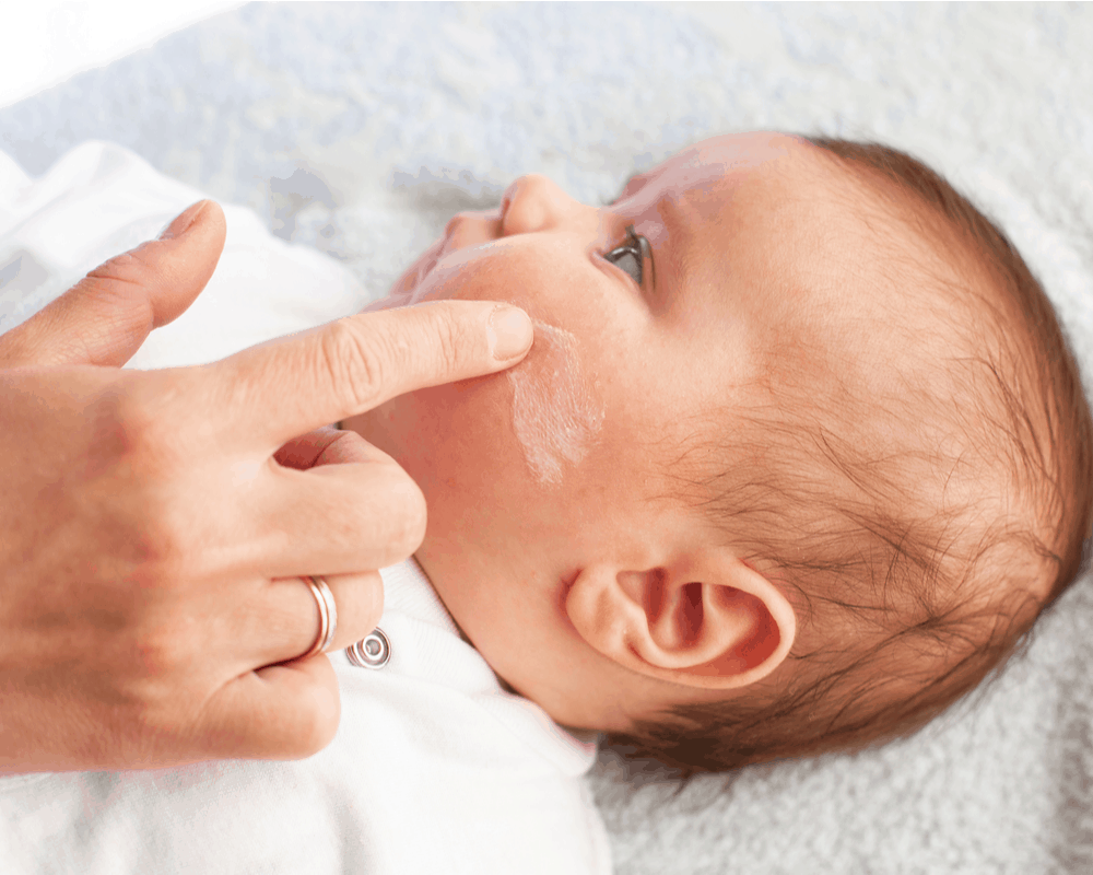causes-symptoms-and-remedies-for-baby-eczema