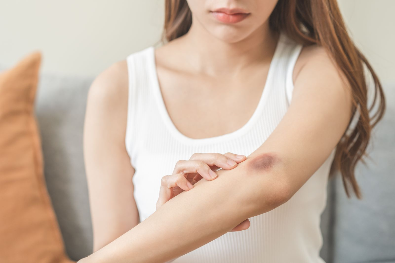 瘀青怎么消？冰敷还是热敷？快速消瘀青6大处理方法与药膏解析