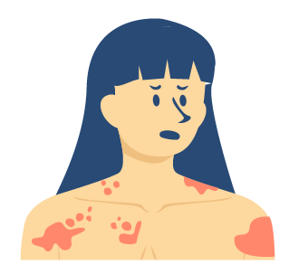 梅毒