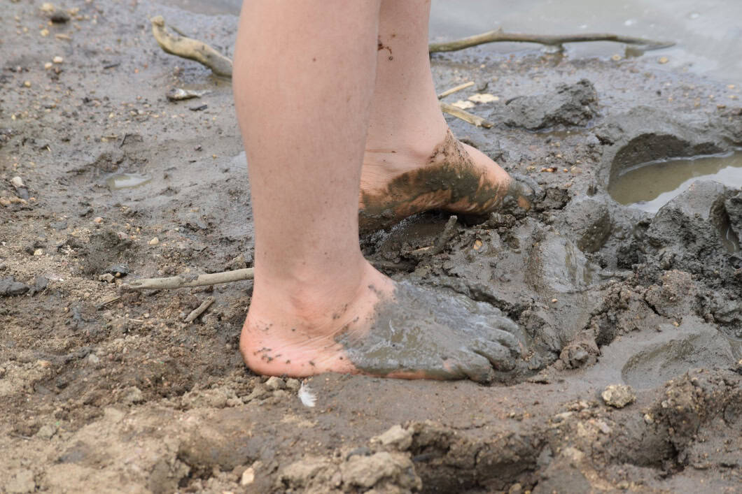understanding-melioidosis