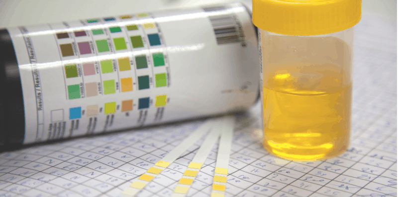 protein-in-urine-and-its-symptoms