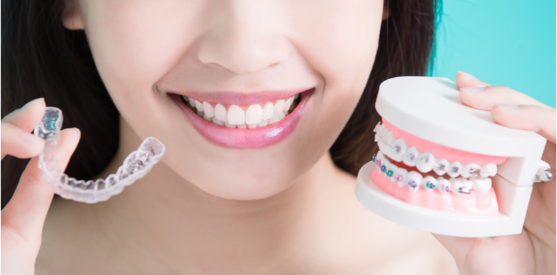 benefits-and-drawbacks-of-clear-braces-compared-to-metal-braces
