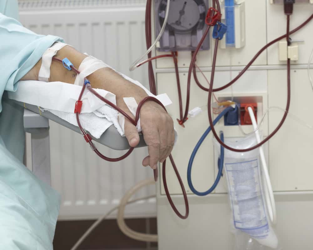 肾脏病离您有多远？肾小球过滤率与肾功能的关系