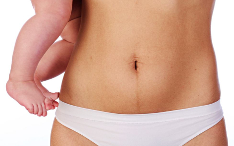 physical-recovery-after-childbirth