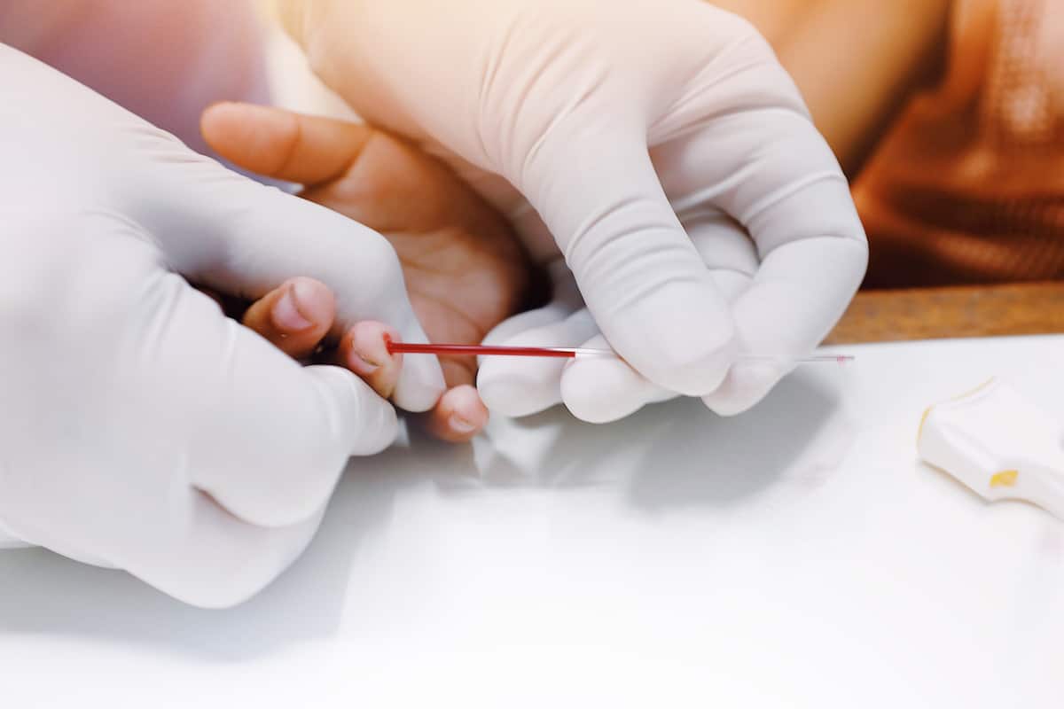 understanding-thrombocytopenia