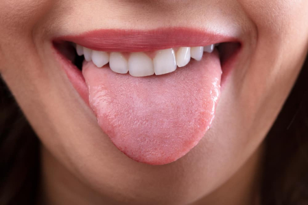 your-tongue-reflects-your-health