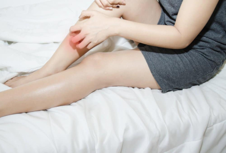 understanding-erythema-nodosum