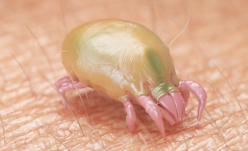 understanding-scabies-and-how-to-deal-with-it