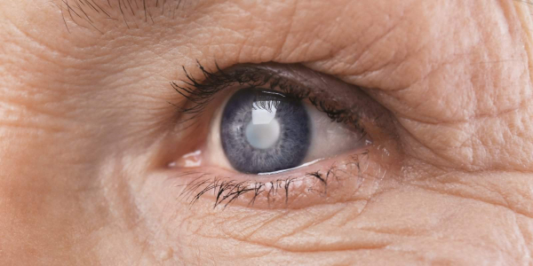 白内障6大症状、原因！手术费用 & 人工水晶体一次看懂