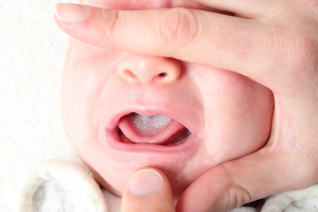 baby-at-fifteen-weeks-old