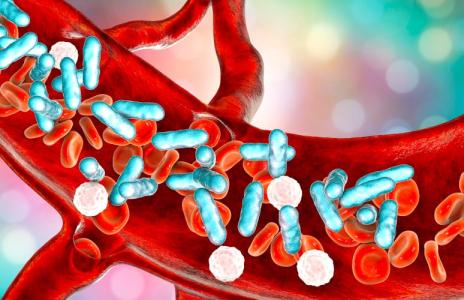 understanding-sepsis
