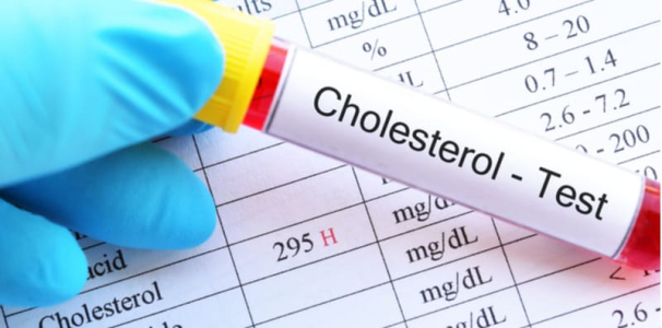 low-density-lipoprotein-cholesterol