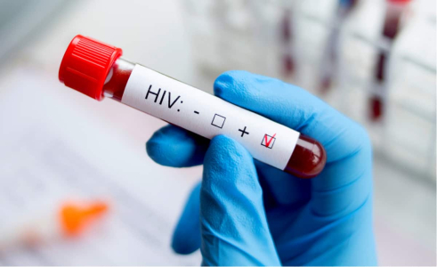 HIV（人类免疫缺陷病毒）：认识传播方式、症状与预防