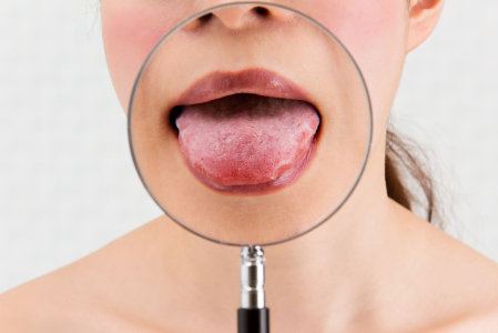 understanding-a-painful-tongue-and-oral-health-issues