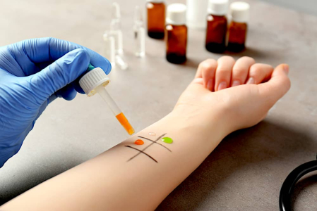 skin-tests-used-to-identify-allergens